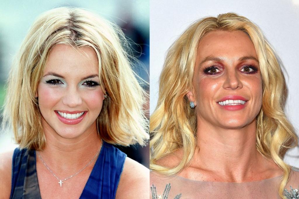 Britney Spears, Instagram, Surgery