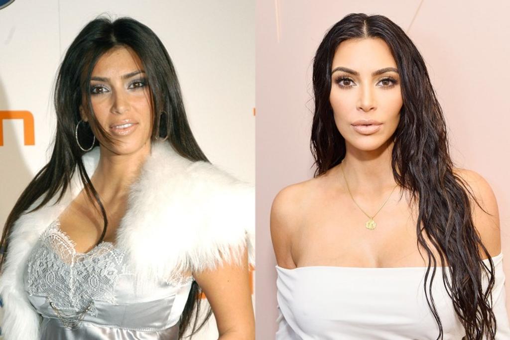 Kim Kardashian, Makeup, Surgery