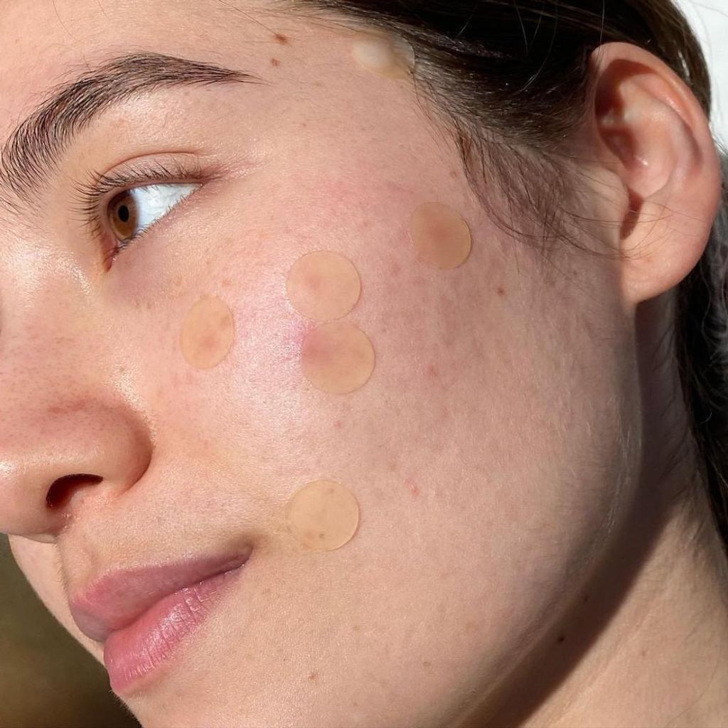 skincare acne treatments stickers